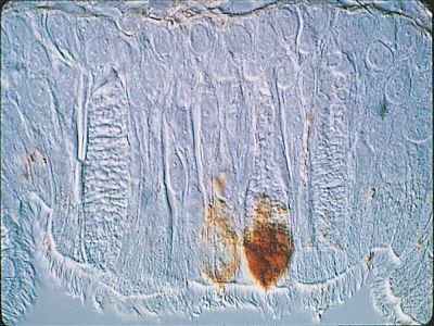 Peanut Agglutinin (PNA), Agarose bound