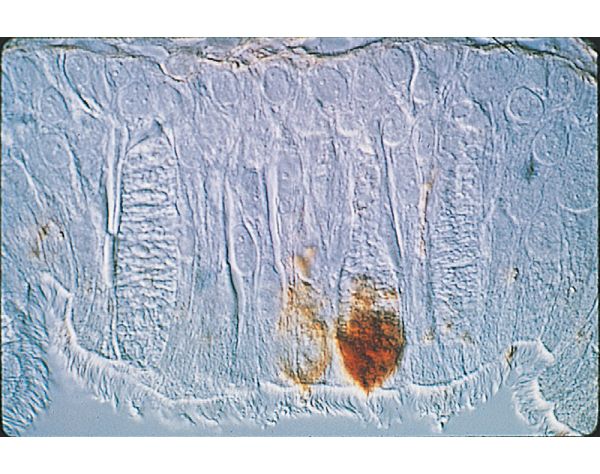 Peanut Agglutinin (PNA), Unconjugated