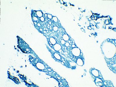 Horseradish Peroxidase Avidin D (Av-HRP), Concentrate, for ELISAs and Blots