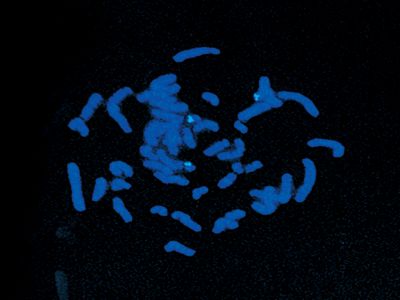 Goat Anti-Human Lambda Chain Antibody, Fluorescein