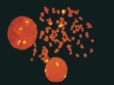 Goat Anti-Human Lambda Chain Antibody, Fluorescein