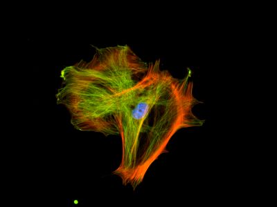 Goat Anti-Human Lambda Chain Antibody, Fluorescein