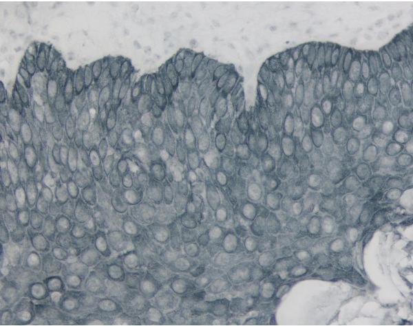 ImmPACT® SG Substrate, Peroxidase (HRP)