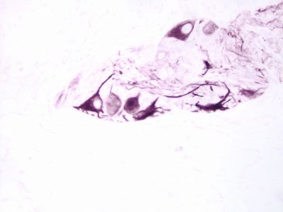 Horseradish Peroxidase Avidin D (Av-HRP), Concentrate, for IHC