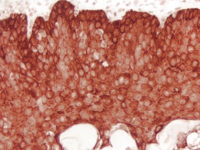 Horseradish Peroxidase Avidin D (Av-HRP), Concentrate, for IHC