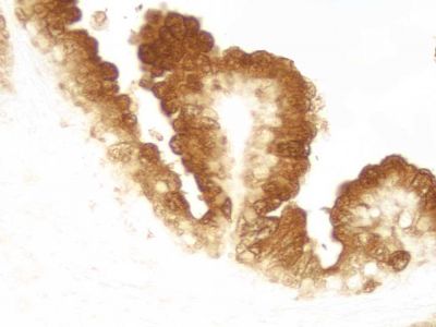 Horseradish Peroxidase Avidin D (Av-HRP), Concentrate, for IHC