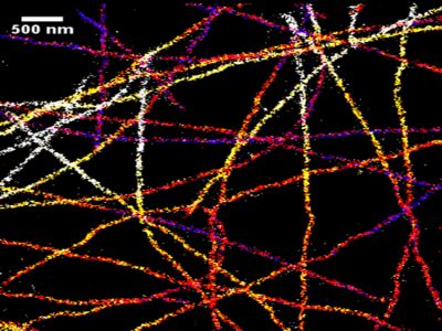 Goat Anti-Human IgE, epsilon chain specific, Fluorescein