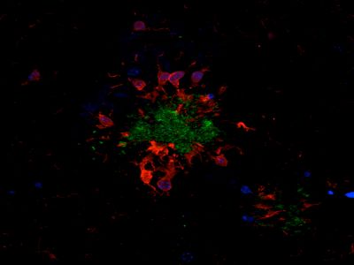 Goat Anti-Human IgE, epsilon chain specific, Fluorescein