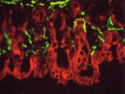 Goat Anti-Human IgE Antibody, epsilon chain specific, Biotinylated