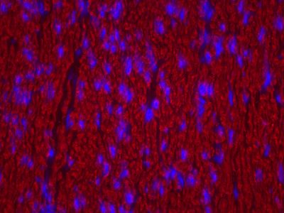 Goat Anti-Human IgE Antibody, epsilon chain specific, Biotinylated