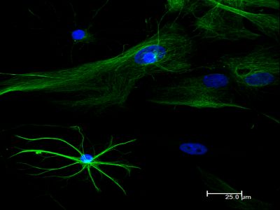 Goat Anti-Human IgE Antibody, epsilon chain specific, Biotinylated