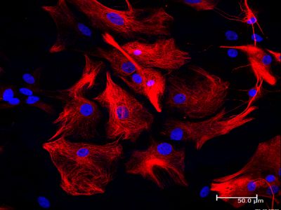 Goat Anti-Human IgE Antibody, epsilon chain specific, Biotinylated