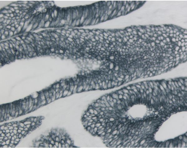 Vector® SG Substrate Kit, Peroxidase (HRP)